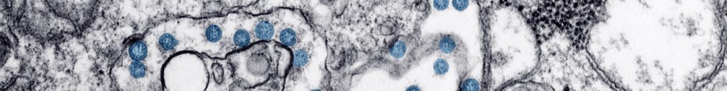 Microscope view of virus