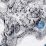 virus slide